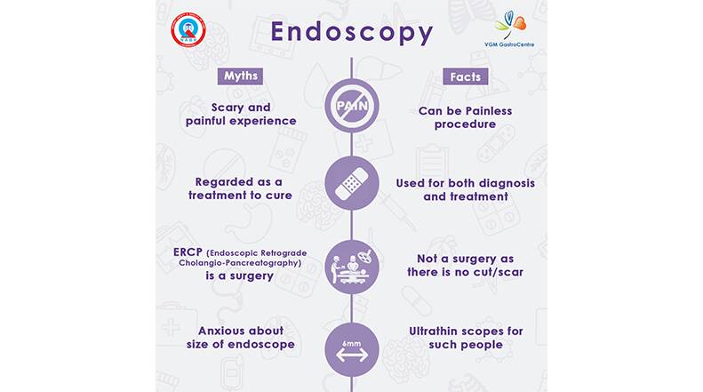 Myths about endoscopy busted