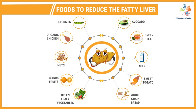 Foods to Reduce the Fatty Liver