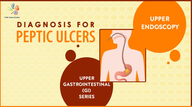 Diagnosis for Peptic Ulcers