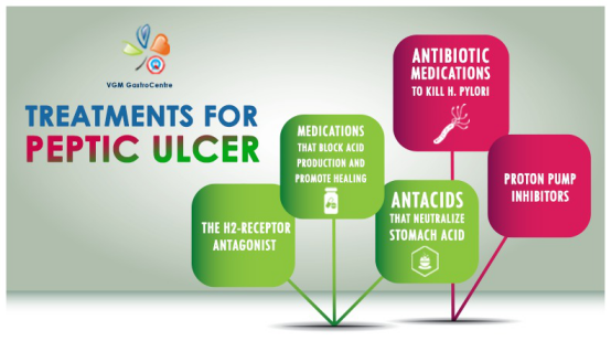 Treatment for Peptic Ulcer