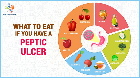 Peptic Ulcer or Stomach ulcer hospital in coimbatore